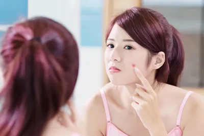 Good Product Sharing! The Ultimate Acne Fighters: Powerful Acne Removal, Easily Get Rid of Acne Troubles!!!